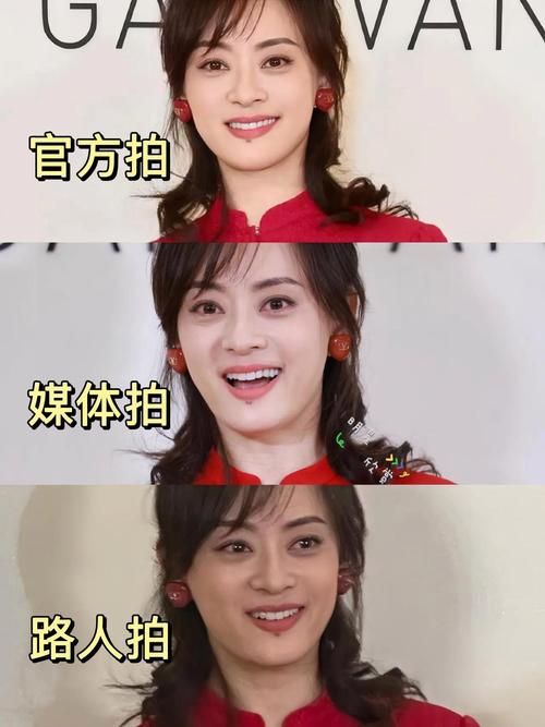 2025新澳门彩历史记录和孙俪唇下痣没了与孙俪嘴唇的痣